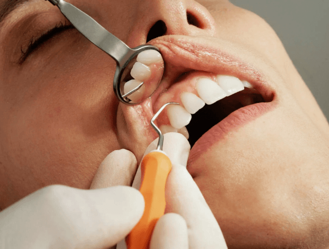 How Preventive Dentistry Supports Smile Design And Reconstruction