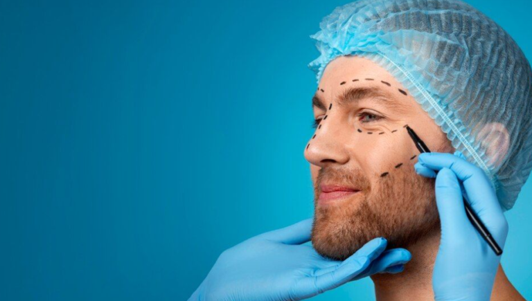 Plastic surgery